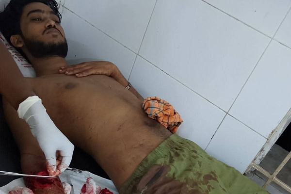 ছাত্রলীগ কর্মীর ওপর হামলা: গাইবান্ধায় ধান কাটতে গিয়ে কুপিয়ে হত্যাচেষ্টার অভিযোগ।