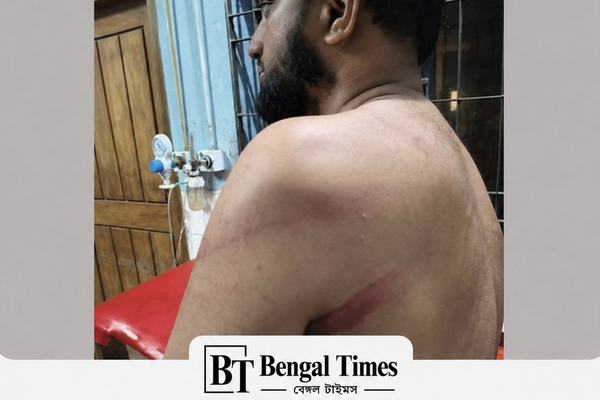 আ.লীগের ঝটিকা মিছিল ঠেকাতে গিয়ে সংঘর্ষ, হাসপাতালে ছাত্রদল-জামায়াতের ৫ নেতা