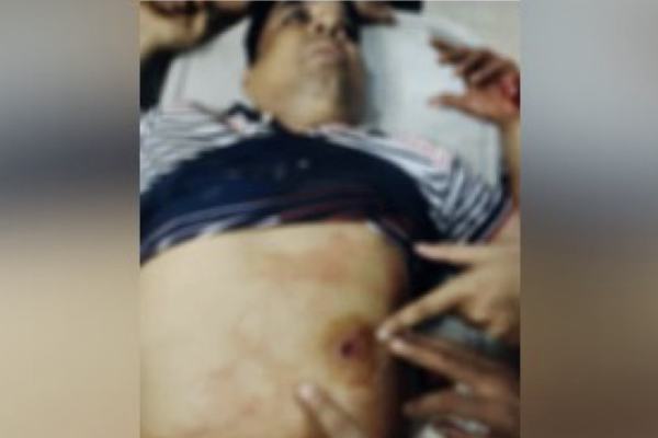 নোয়াখালীতে বিএনপি নেতাকে লক্ষ্য করে গুলি, সহযোগী গুরুতর আহত