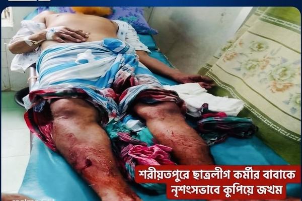 রাজনৈতিক প্রতিহিংসার বলি? শরীয়তপুরে ছাত্রলীগ কর্মীর বাবাকে নৃশংস কুপিয়ে জখম।
